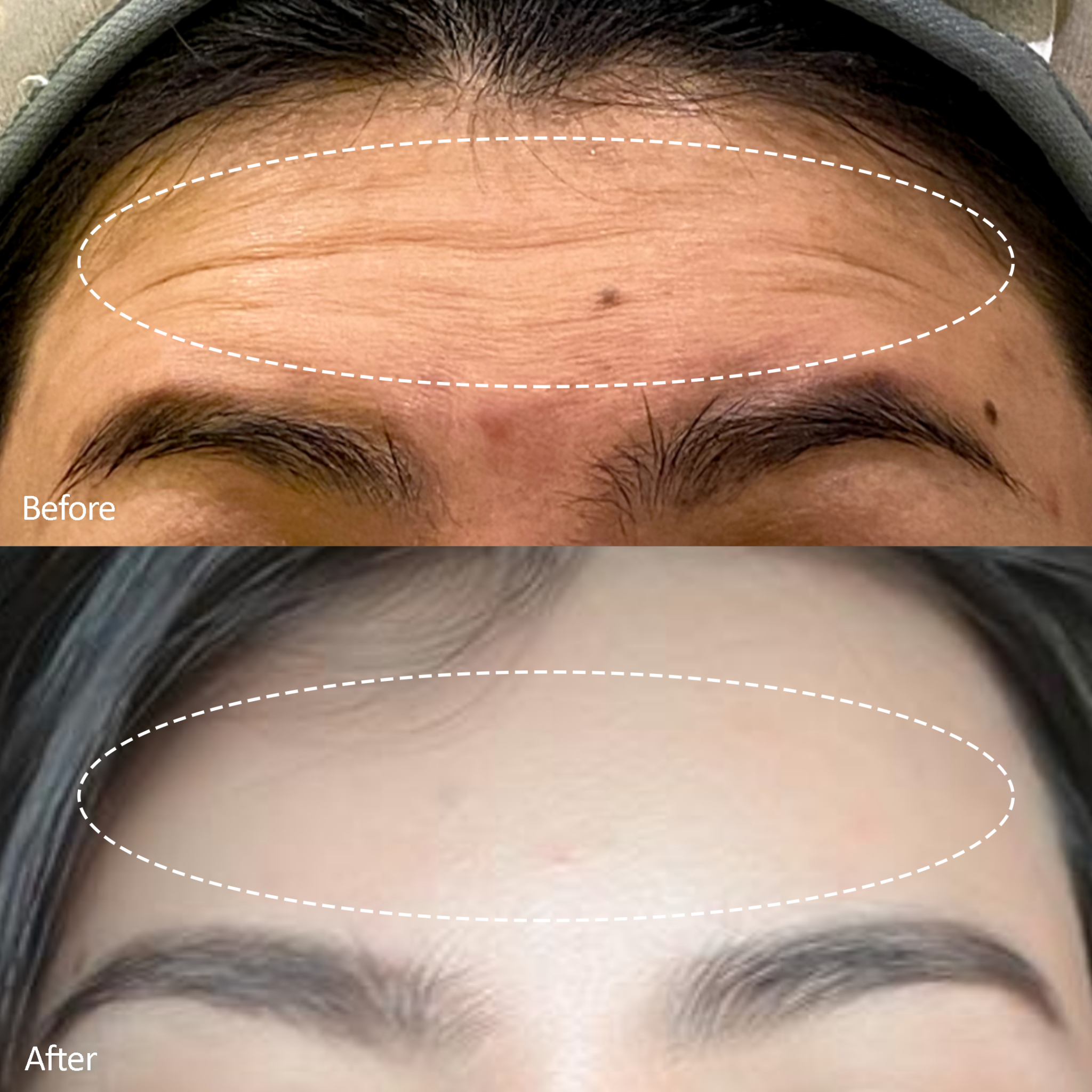 Insta Beauty Aesthetic - Klinik Kecantikan & Face Contouring