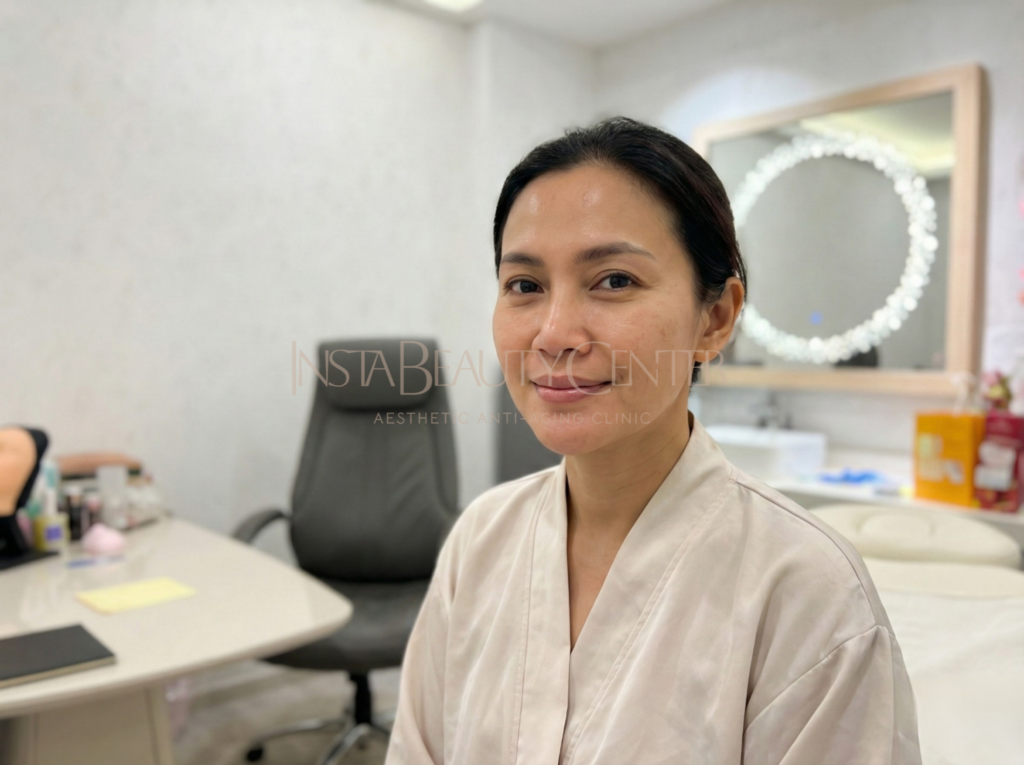 instant facelift treatment kecantikan yang natural