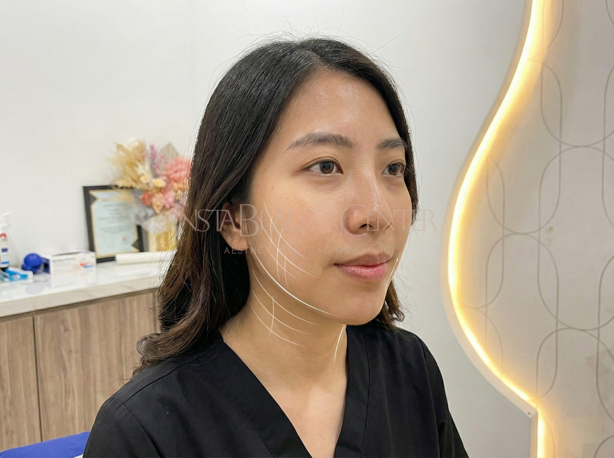 Solusi Facelift Tanpa Operasi & Pengencangan Kulit Total