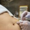 Fat Cell Therapy di Insta Beauty Center_ Kencangkan Kulit, Pudarkan Stretch Marks, dan Percepat Hasil Slimming Tanpa Operasi