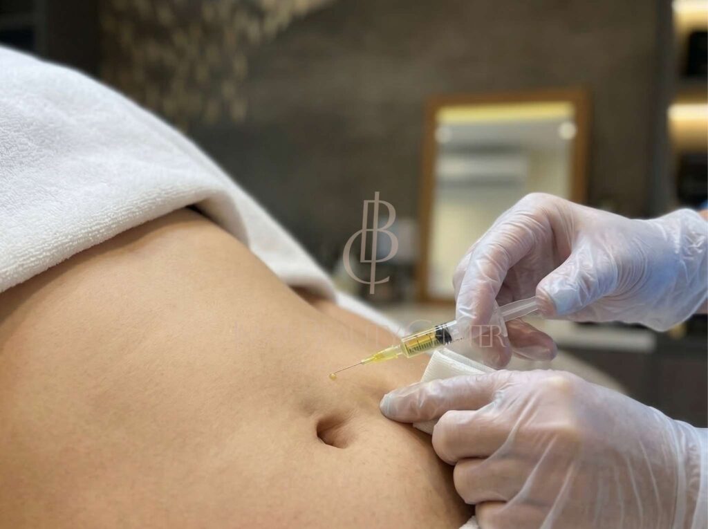 Fat Cell Therapy di Insta Beauty Center_ Kencangkan Kulit, Pudarkan Stretch Marks, dan Percepat Hasil Slimming Tanpa Operasi