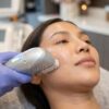 HIFU Wajah_ Cara Kerja, Manfaat, dan Apakah Ini Treatment yang Tepat untuk Kulitmu?