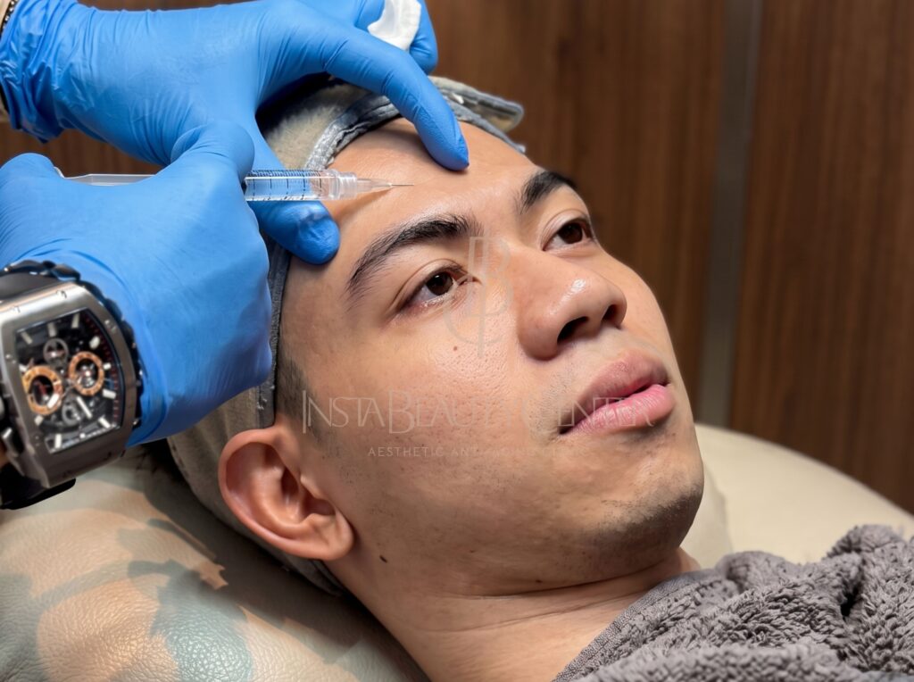 Nucleofill_ Treatment Anti Aging & Glowing Skin yang Merangsang Kolagen Alami