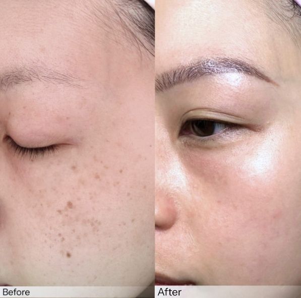 skinbooster insta beauty center