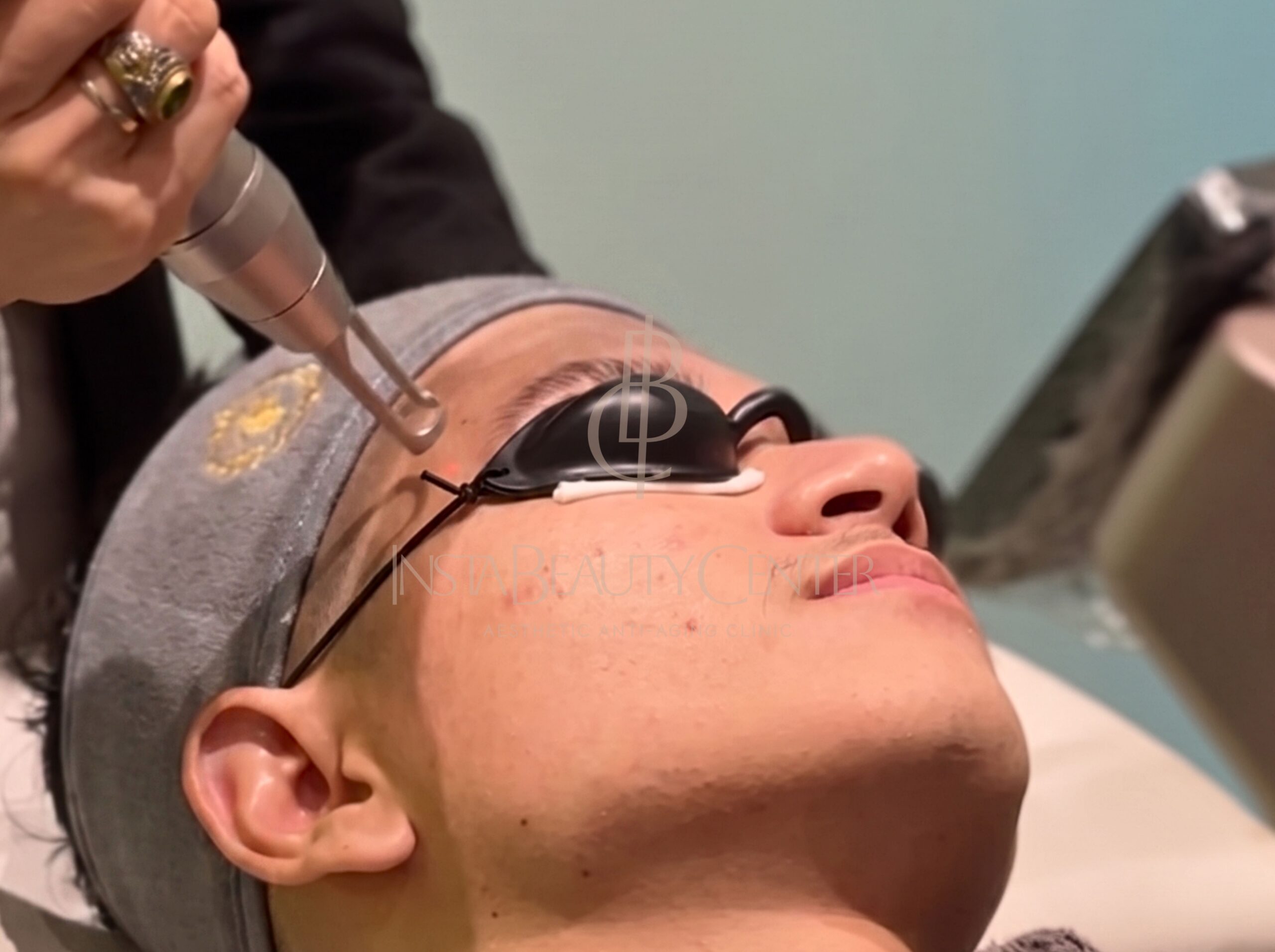 Perawatan Wajah Pria di Insta Beauty Center_ Treatment Modern untuk Cowok yang Ingin Tampil Fresh & Maskulin